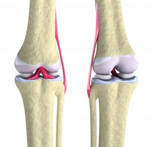How to Continue Running with Arthritis Pain in Jacksonville, Florida