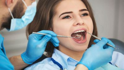 6 Commonly Asked Questions About Veneers from an Elk Grove Village Dentist