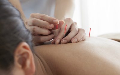 Chronic Pain Relief Found at an Acupuncture Clinic Burbank CA Residents Trust Most